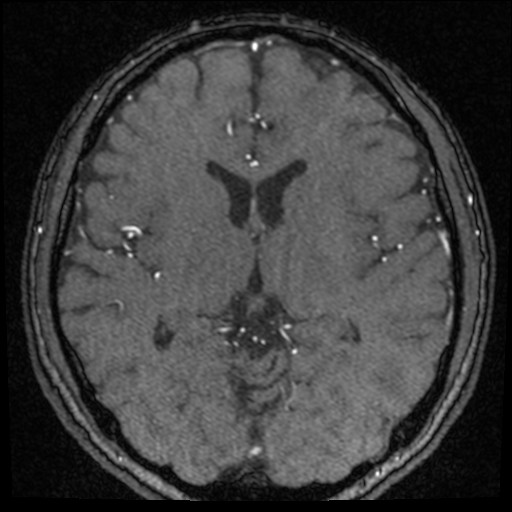 Click on the Serie image to view the images of VILLANUEVA, WILLIAM A.